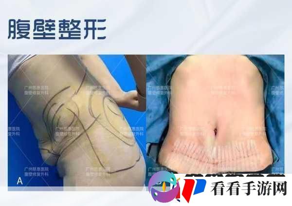 变松了还能变紧吗