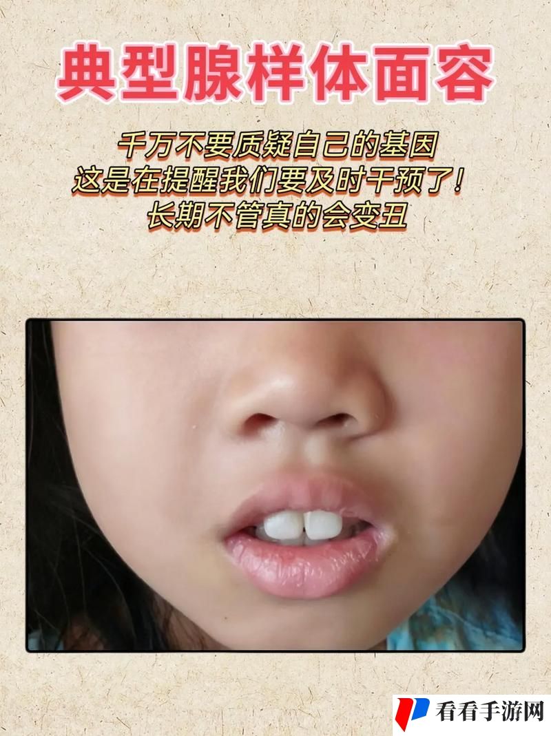 小嘴无力合拢红肿外翻